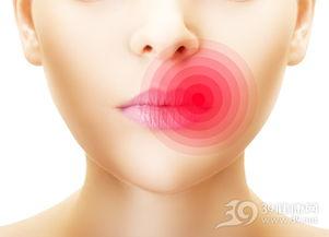 吃绿色瓜烂嘴角,烂嘴角问题如何应对？